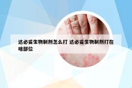 达必妥生物制剂怎么打 达必妥生物制剂打在啥部位