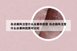 白点癫风注意什么水果和蔬菜 白点癫风注意什么水果和蔬菜可以吃