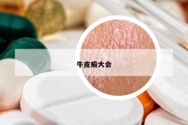 牛皮癣大会