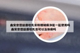 曲安奈德益康唑乳膏和珊瑚癣净能一起使用吗 曲安奈德益康唑乳膏可以治体癣吗