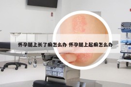 怀孕腿上长了癣怎么办 怀孕腿上起癣怎么办