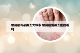 银屑病有必要去大城市 银屑病需要去医院看吗