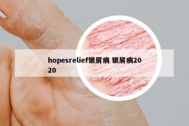 hopesrelief银屑病 银屑病2020