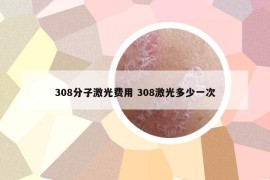 308分子激光费用 308激光多少一次