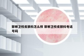 邯郸卫校皮肤科怎么样 邯郸卫校皮肤科电话号码