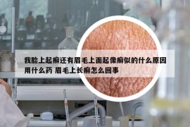 我脸上起癣还有眉毛上面起像癣似的什么原因用什么药 眉毛上长癣怎么回事