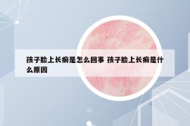 孩子脸上长癣是怎么回事 孩子脸上长癣是什么原因