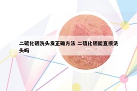 二硫化硒洗头发正确方法 二硫化硒能直接洗头吗