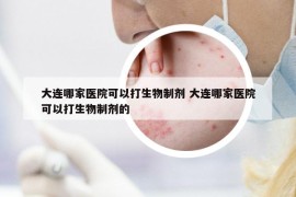 大连哪家医院可以打生物制剂 大连哪家医院可以打生物制剂的