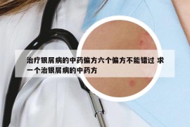 治疗银屑病的中药偏方六个偏方不能错过 求一个治银屑病的中药方