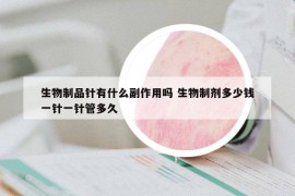生物制品针有什么副作用吗 生物制剂多少钱一针一针管多久