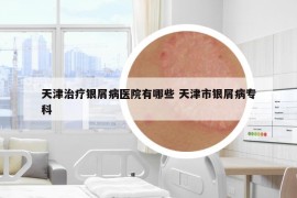 天津治疗银屑病医院有哪些 天津市银屑病专科