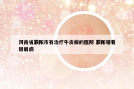 河南省濮阳市有治疗牛皮癣的医院 濮阳哪看银屑病