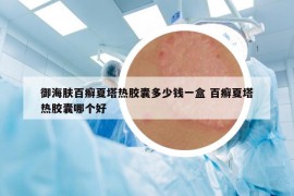 御海肤百癣夏塔热胶囊多少钱一盒 百癣夏塔热胶囊哪个好