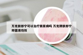 万克肤即宁可以治疗银屑病吗 万克牌肤即宁抑菌液功效