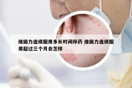 维固力连续服用多长时间停药 维固力连续服用超过三个月会怎样