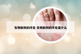 生物制剂的坏处 生物制剂的坏处是什么