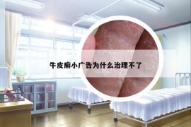 牛皮癣小广告为什么治理不了