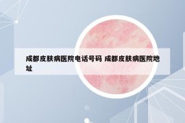 成都皮肤病医院电话号码 成都皮肤病医院地址