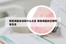 银屑病是身体缺什么元素 银屑病是缺乏哪种维生素