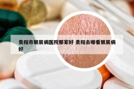 贵阳市银屑病医院那家好 贵阳去哪看银屑病好