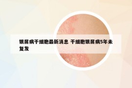 银屑病干细胞最新消息 干细胞银屑病5年未复发