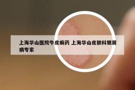 上海华山医院牛皮癣药 上海华山皮肤科银屑病专家