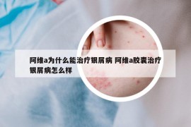 阿维a为什么能治疗银屑病 阿维a胶囊治疗银屑病怎么样