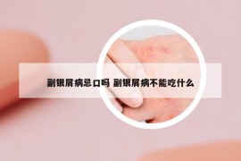 副银屑病忌口吗 副银屑病不能吃什么