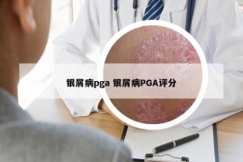银屑病pga 银屑病PGA评分