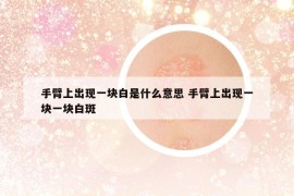 手臂上出现一块白是什么意思 手臂上出现一块一块白斑