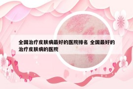 全国治疗皮肤病最好的医院排名 全国最好的治疗皮肤病的医院