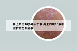 身上白斑10多年没扩散 身上白斑10多年没扩散怎么回事