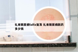 礼来银屑病taltz复发 礼来银屑病新药多少钱