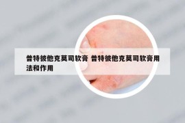 普特彼他克莫司软膏 普特彼他克莫司软膏用法和作用