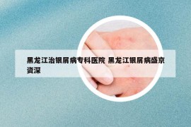 黑龙江治银屑病专科医院 黑龙江银屑病盛京资深