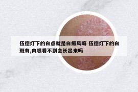 伍德灯下的白点就是白癜风嘛 伍德灯下的白斑有,肉眼看不到会长出来吗