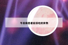 牛皮癣患者应该吃的食物
