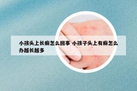 小孩头上长癣怎么回事 小孩子头上有癣怎么办越长越多