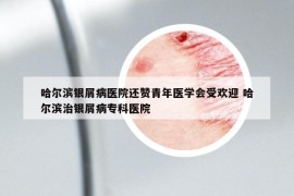 哈尔滨银屑病医院还赞青年医学会受欢迎 哈尔滨治银屑病专科医院