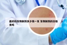 最好的生物制剂多少钱一支 生物制剂的价格贵吗