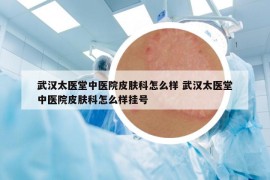 武汉太医堂中医院皮肤科怎么样 武汉太医堂中医院皮肤科怎么样挂号