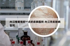 内江哪里有好一点的皮肤医院 内江市皮肤病医院