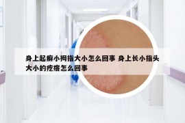 身上起癣小拇指大小怎么回事 身上长小指头大小的疙瘩怎么回事