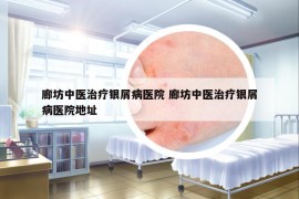 廊坊中医治疗银屑病医院 廊坊中医治疗银屑病医院地址