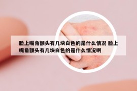 脸上嘴角额头有几块白色的是什么情况 脸上嘴角额头有几块白色的是什么情况啊