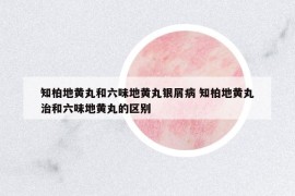 知柏地黄丸和六味地黄丸银屑病 知柏地黄丸治和六味地黄丸的区别