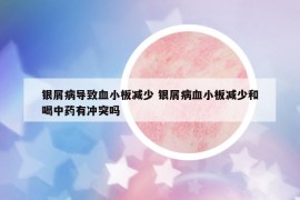 银屑病导致血小板减少 银屑病血小板减少和喝中药有冲突吗
