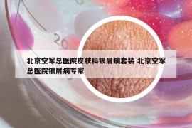 北京空军总医院皮肤科银屑病套装 北京空军总医院银屑病专家