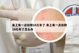 身上有一点白斑10几年了 身上有一点白斑10几年了怎么办